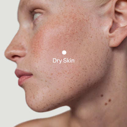 ClinSol Glycolic Acid 10% Cream